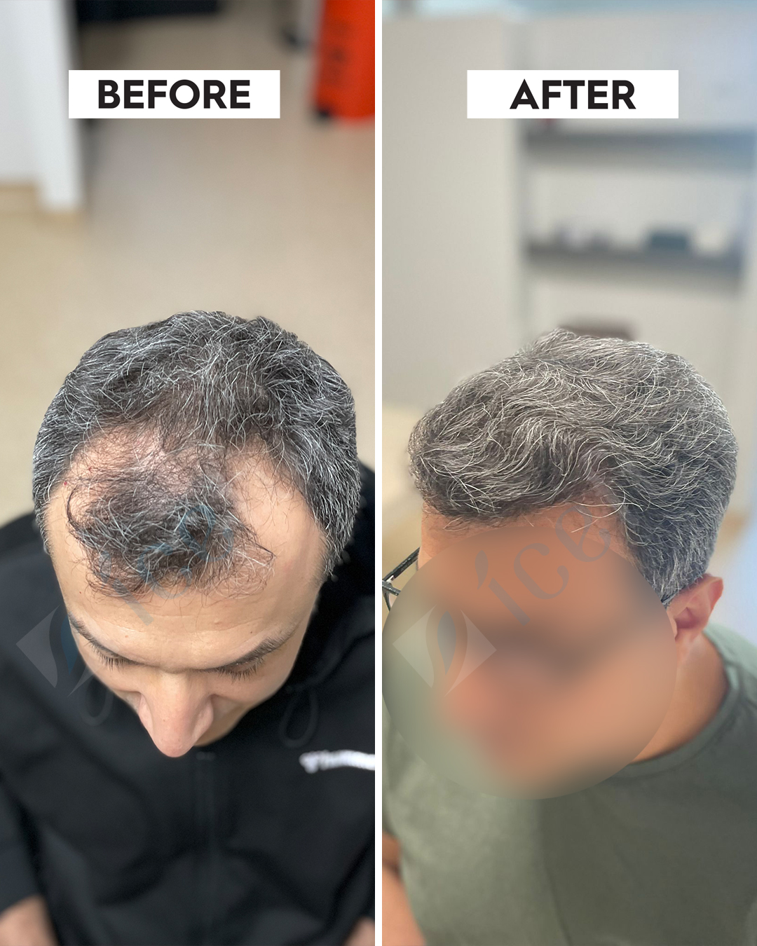 Real Results - Before & After Transformations | ICEFUE